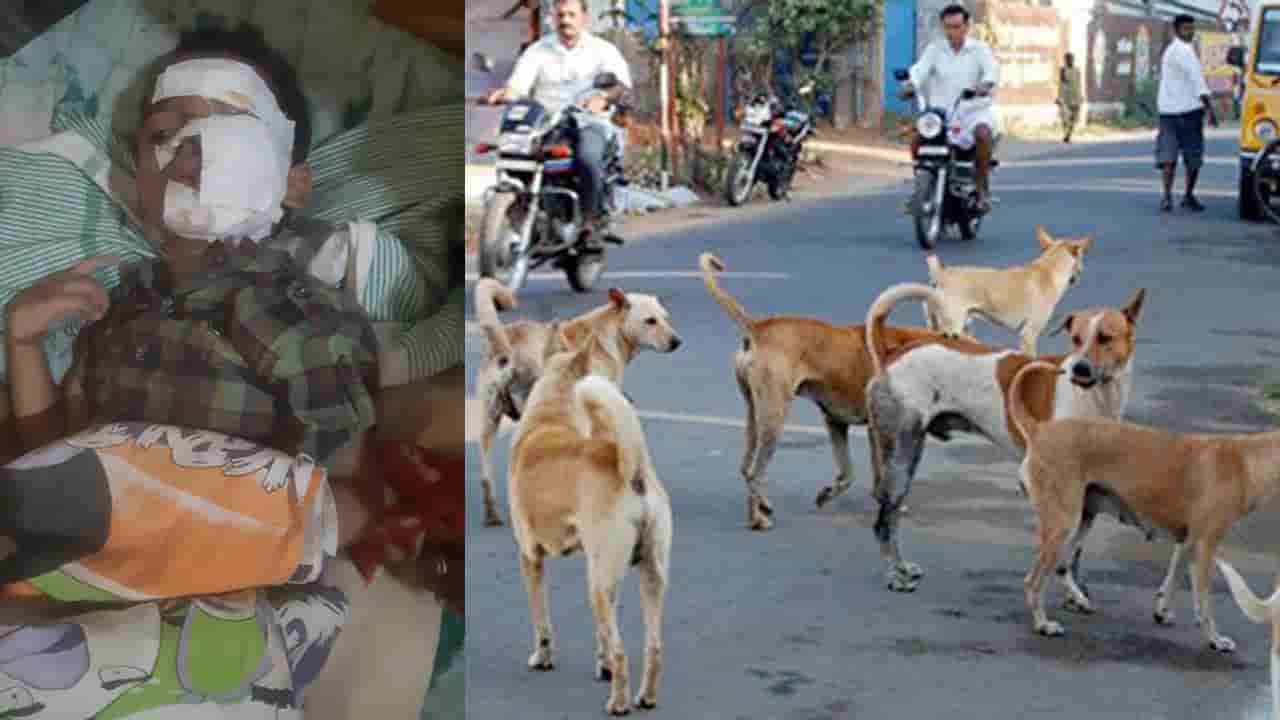 Hyderabad: వీధి కుక్కల దాడిలో గాయాలపాలైన మరో బాలుడు.. జీహెచ్ఎంసీ అధికారులపై స్థానికులు ఆగ్రహం..
