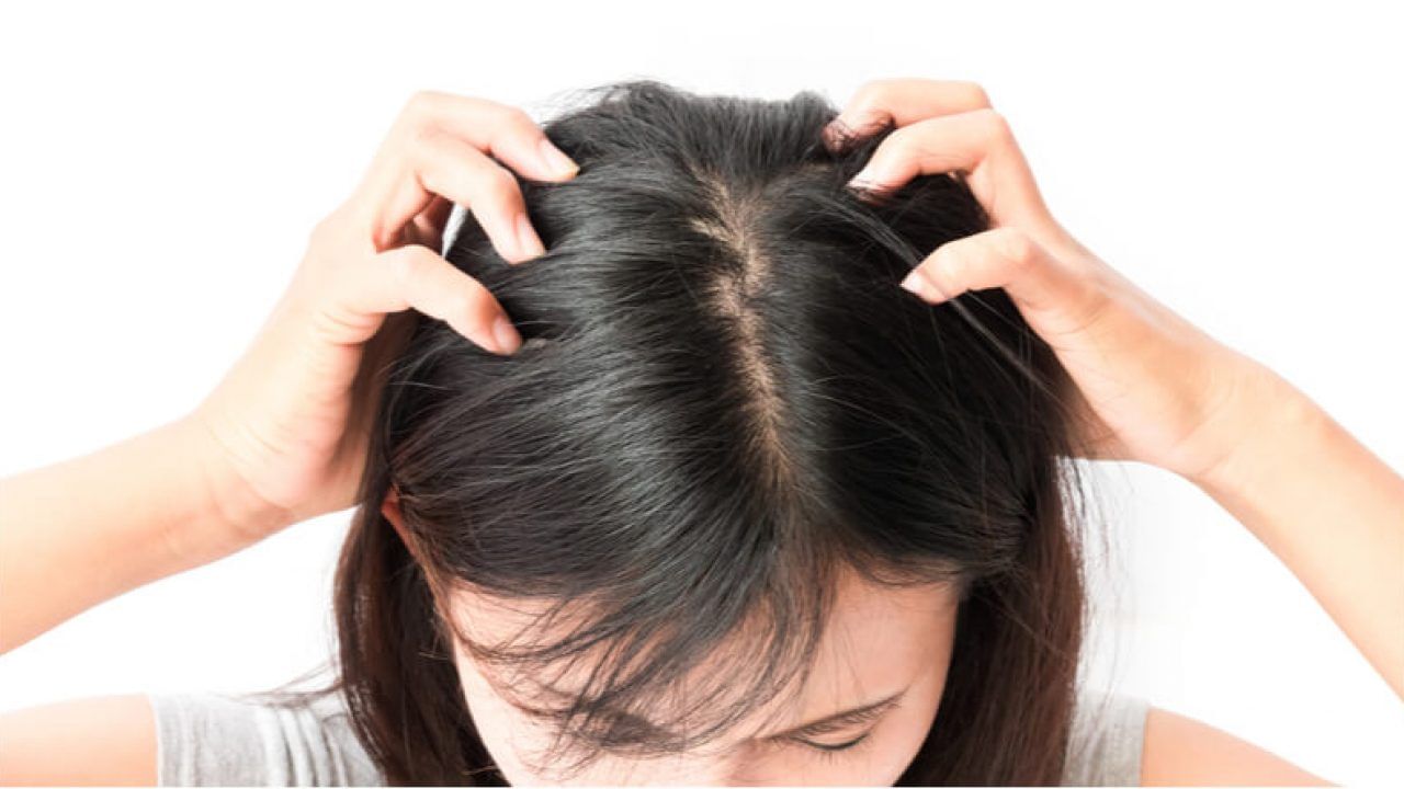 ఇంట్లో లభించే బేకింగ్ సోడాతో కూడా పేలను తరిమి కొట్టొచ్చు. కొద్దిగా బేకింగ్ సోడాతో కండీషనర్ కలిపి తలకు అప్లై చేయండి. ఓ పావు గంట తర్వాత.. షాంపూతో తలను క్లీన్ చేసుకోండి. ఇలా చేస్తే పేలు చచ్చిపోతాయి.