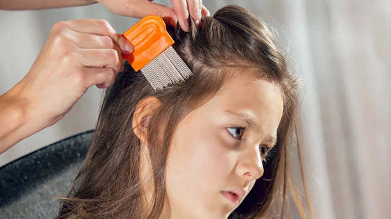 వేపాకులతో కూడా పేలను దూరం చేసుకోవచ్చు. వేపాకులను శుభ్రంగా కడిగి, పేస్టులో చేసుకోవాలి. ఈ పేస్టును పావు గంట పాటు తలకు పట్టించి.. షాంపూతో స్నానం చేయండి. వేపాకుల్లోని చేదు, ఘాటు వాసన కారణంగా పేలు చనిపోతాయి. అలాగే జుట్టు కూడా ఆరోగ్యంగా ఉంటుంది.