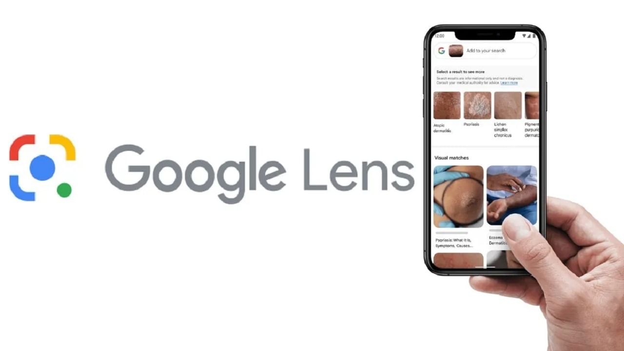 Google Lens: మీ ఫోనే మీ స్కిన్‌ స్పెషలిస్ట్‌! ఒక్క ఫొటోతో చర్మ సమస్యలపై పూర్తి సమాచారం..