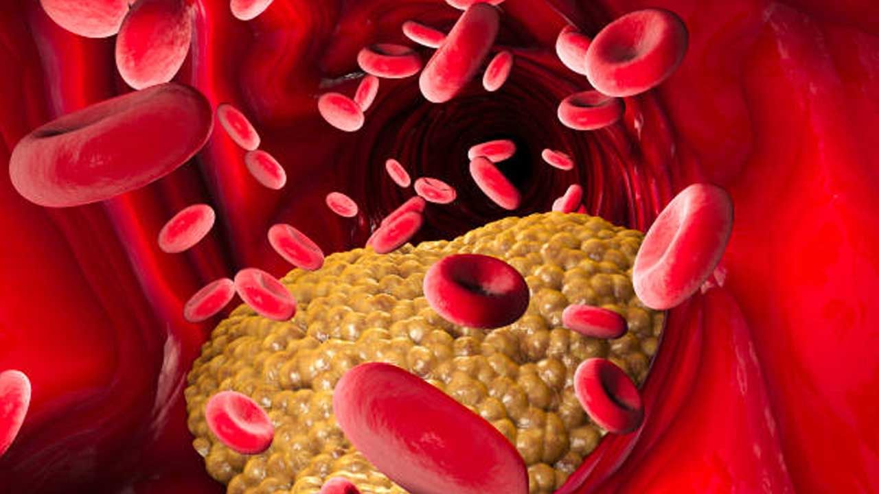Cholesterol Facts: కొలెస్ట్రాల్ గురించి ముఖ్యమైన విషయాలు.. అస్సలు స్కిప్ చేయకండి!