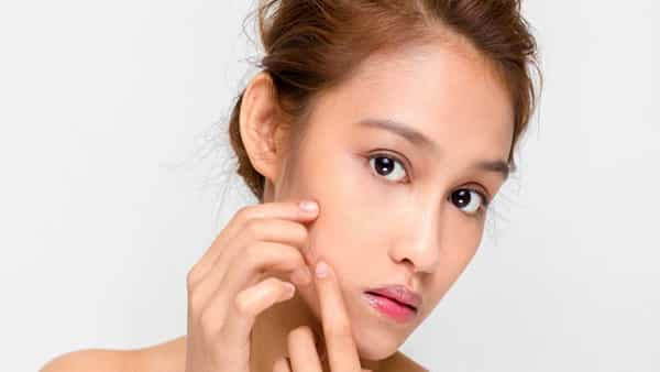 Period Acne: పీరియడ్స్ ముందు తర్వాత ముఖంపై మొటిమలు ఎందుకు వస్తాయి?