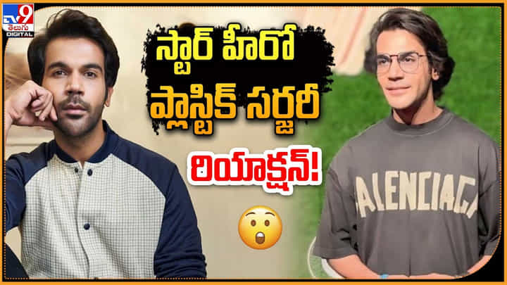 స్టార్ హీరో ప్లాస్టిక్ సర్జరీ.. రియాక్షన్ !! స్టార్ హీరో ప్లాస్టిక్ సర్జరీ.. రియాక్షన్ !!