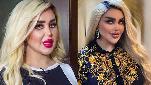 Real-life Barbie: అందంగా బార్బీగా మారాలని 43 సర్జరీలు చేయించుకున్న స్త్రీ.. చివరికి భయపెట్టే వింత రూపం..