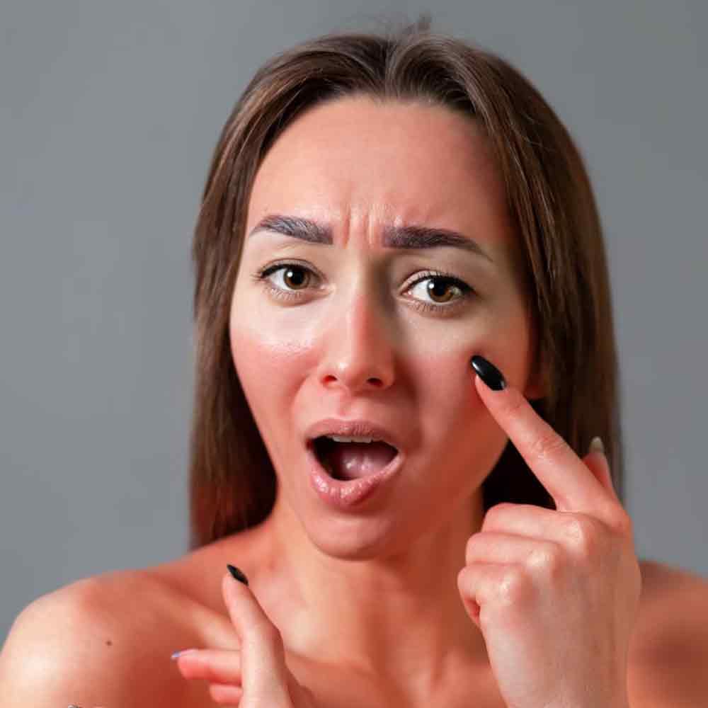 వేసవిలో సర్వసాధారణమైన చర్మ సమస్యలలో సన్ టాన్ ఒకటి. సూర్యుని తీవ్రమైన వేడి మన చర్మాన్ని అనేక విధాలుగా ప్రభావితం చేస్తుంది. నేరుగా సూర్యకిరణాలకు గురికావడం వల్ల మన చర్మం డల్‌గా, టాన్‌గా కనిపిస్తుంది. సూర్యరశ్మిలో విటమిన్ డి ఉంటుంది. అది మన ఆరోగ్యానికి ఎంతో మంచిది. అయినప్పటికీ UV కిరణాలకు గురికావటం వల్ల శరీరంలో విటమిన్ D, మెలనిన్ సంశ్లేషణను వేగవంతం చేస్తుంది. ఎండలో ఎక్కువగా బయటకు వెళ్లేవారికి చర్మంలో మెలనిన్ పిగ్మెంట్ స్థాయి పెరుగుతుంది. ఫలితంగా చర్మం ముదురు రంగులోకి మారుతుంది. 