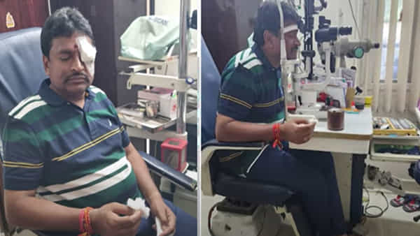 Vellampalli Srinivas: కనుగుడ్డుపై గీతలు పడ్డాయి.. కుట్ర, హత్యా రాజకీయాలు ఆపాలి: వెల్లంపల్లి శ్రీనివాస్