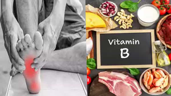 Vitamin B12: రక్తహీనతతో ఇబ్బంది పడుతున్నారా.. విటమిన్ బి12 లోపం ఏమో చెక్ చేసుకోండి