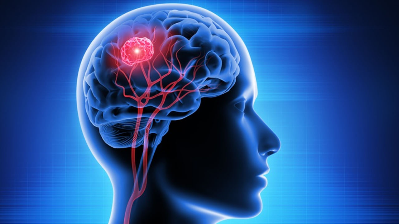Brain Cancer: ఈ లక్షణాలను అస్సలు లైట్ తీసుకోకండి.. బ్రెయిన్‌ క్యాన్సర్‌ కావొచ్చు