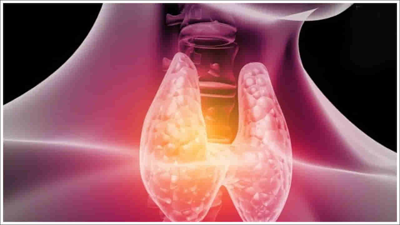 Health Tips: థైరాయిడ్ సమస్యలు ఉన్నవారు ఈ ఆహారాలు తినకూడదు
