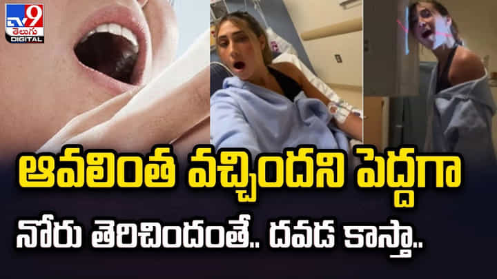 ఆవలింత వచ్చిందని పెద్దగా నోరు తెరిచిందంతే.. దవడ కాస్తా ?? ఆవలింత వచ్చిందని పెద్దగా నోరు తెరిచిందంతే.. దవడ కాస్తా ??
