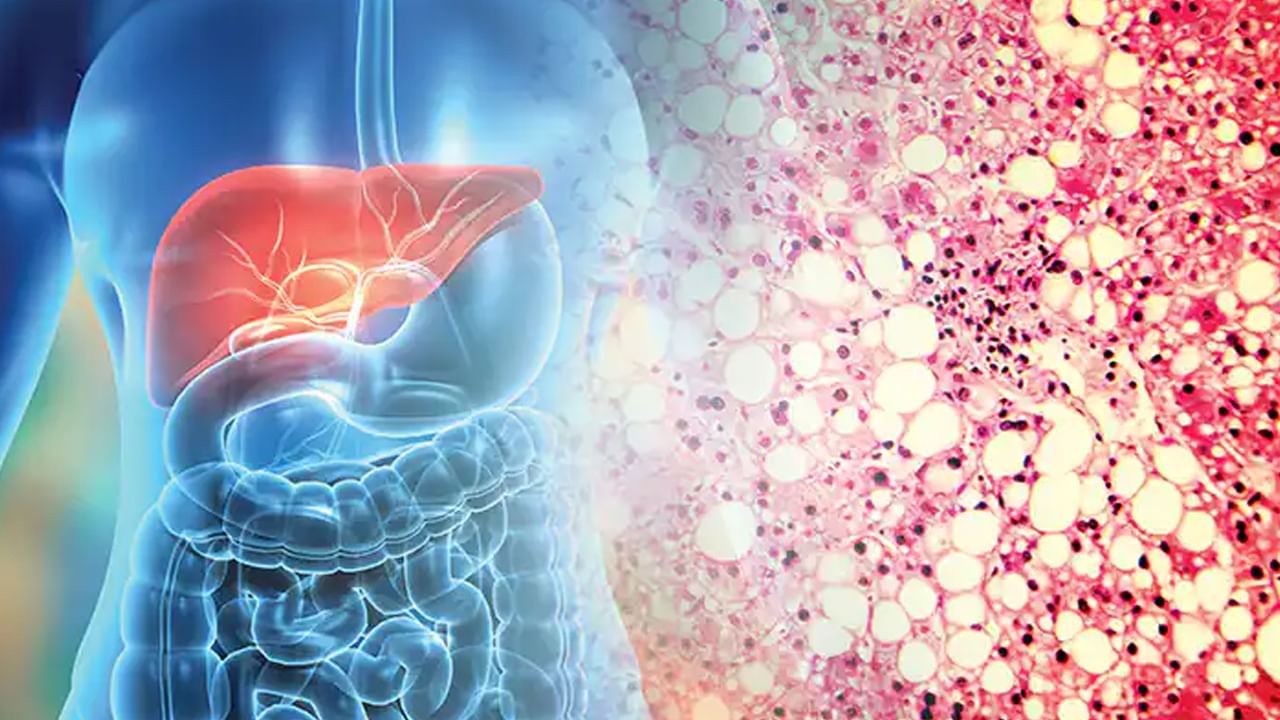 Health: ఇలా చేస్తే.. పాడైపోయిన లివర్ ఒక్క దెబ్బతో శుభ్రం అవుతుంది..
