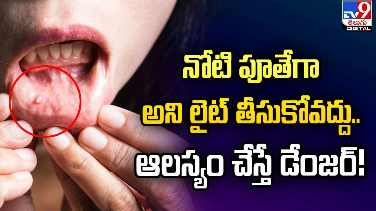 నోటి పూతేగా అని లైట్ తీసుకోవద్దు.. ఆలస్యం చేస్తే డేంజర్‌