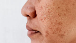 Sunflower seeds: పోషకాల్లో తిరుగులేని పొద్దుతిరుగుడు.. తింటే అద్భుతమైన శక్తి