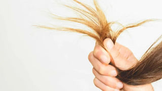 Calcium Deficiency: కాళ్లు, చేతుల్లో ఒకటే నొప్పులా.. అయితే క్యాల్షియం లోపించినట్లే..