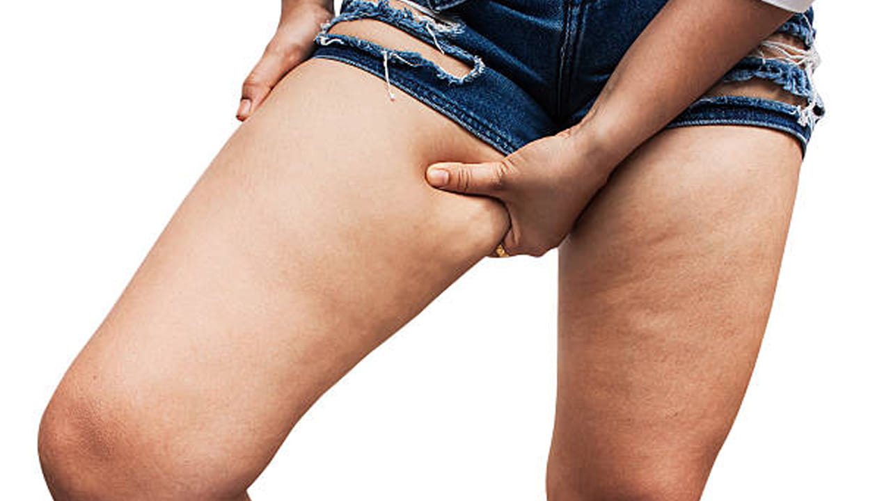 మెట్లు ఎక్కుతూ దిగుతూ ఉండటం వల్ల కూడా తొడల్లో ఉండే ఫ్యాట్‌ను ఈజీగా కరిగించుకోవచ్చు. జిమ్‌కి వెళ్లకుండానే ఇలా థై ఫ్యాట్ తగ్గించుకోవచ్చు. లిఫ్ట్స్, ఎస్కలేటర్స్ బదులు మెట్లు ఎక్కండి. ఇది తొడలకు మంచి ఎక్సర్ సైజ్.
