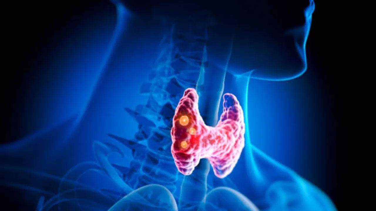 థైరాయిడ్ గ్రంధి నుంచి థైరాక్సిన్ హార్మోన్ స్రవిస్తుంది. థైరాయిడ్ గ్రంధి సరిగ్గా పని చేయకపోతే, ఈ హార్మోన్ నిర్దేశిత పరిమాణం కంటే ఎక్కువ లేదా తక్కువగా స్రవిస్తుంది. ఇది థైరాయిడ్ వ్యాధికి దారి తీస్తుంది.