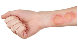 Garlic Peel Benefits: వార్నీ వెల్లుల్లి తొక్కలకు ఇంతుందా..? తెలిస్తే..  ఇకపై భద్రంగా దాచుకోవాల్సిందే..!