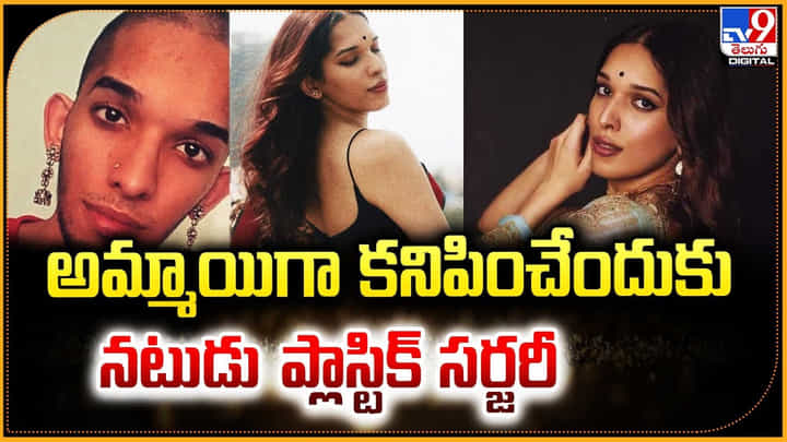 అమ్మాయిగా కనిపించేందుకు నటుడు ప్లాస్టిక్ సర్జరీ !! అమ్మాయిగా కనిపించేందుకు నటుడు ప్లాస్టిక్ సర్జరీ !!