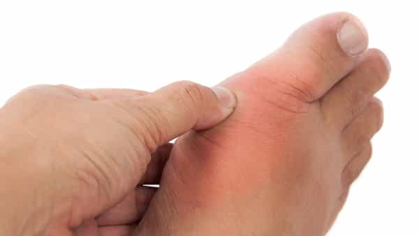 Uric Acid: ఈ కూరగాయలు తింటే యూరిక్ యాసిడ్ కంట్రోల్ అవ్వాల్సిందే.. డోంట్ మిస్!