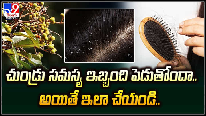 Dandruff Problem: చుండ్రు సమస్య ఇబ్బంది పెడుతోందా.. అయితే ఇలా చేయండి.! Dandruff Problem: చుండ్రు సమస్య ఇబ్బంది పెడుతోందా.. అయితే ఇలా చేయండి.!