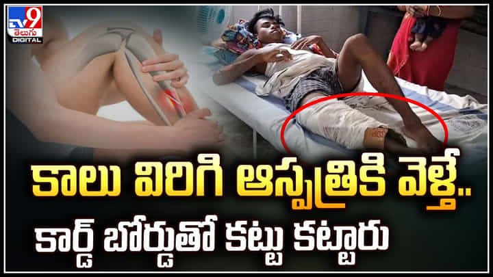 Viral: కాలు విరిగి ఆస్పత్రికి వెళ్తే.. డాక్టర్లు ఏం చేశారో తెలుసా.? వీడియో వైరల్.. Viral: కాలు విరిగి ఆస్పత్రికి వెళ్తే.. డాక్టర్లు ఏం చేశారో తెలుసా.? వీడియో వైరల్..