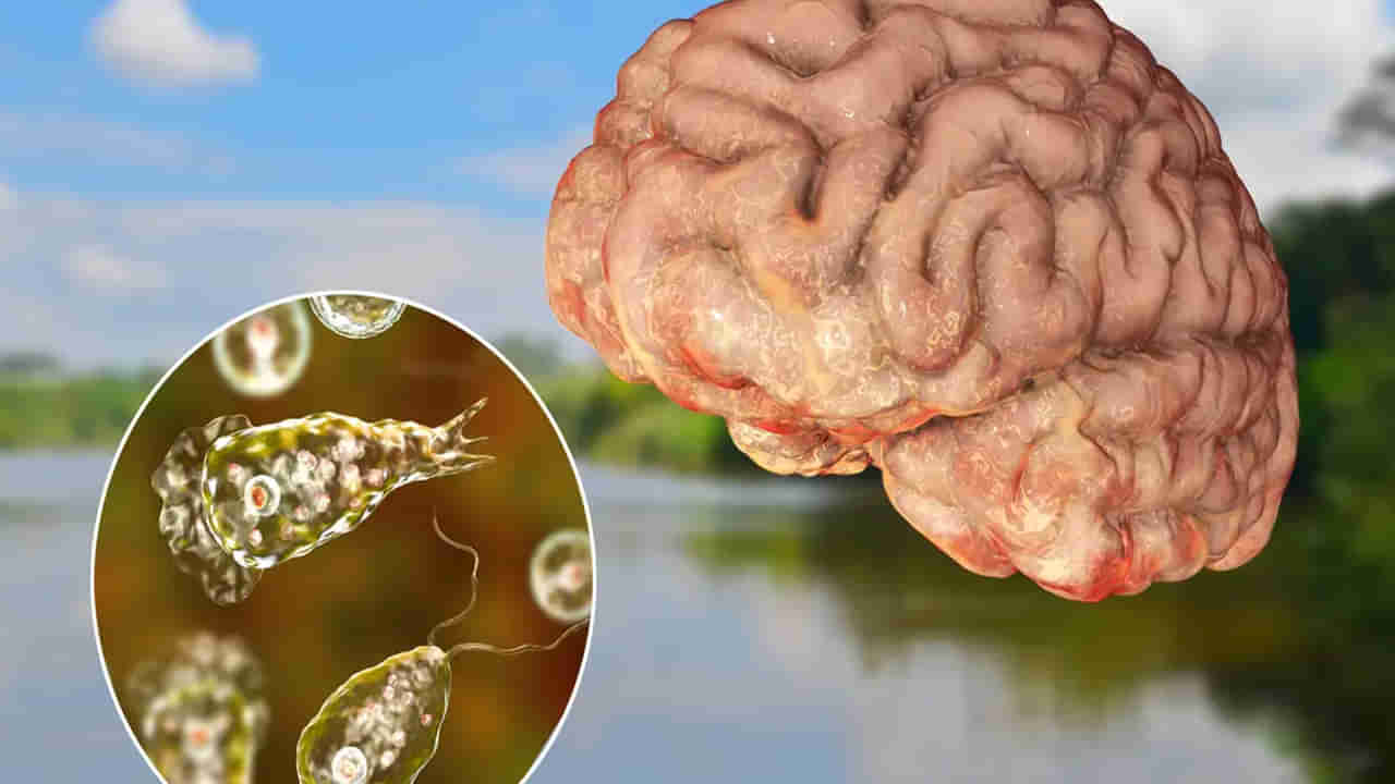 Brain-Eating Amoeba: “మెదడును తినే అమీబా” ఐదేళ్ల బాలికను మింగేసింది..