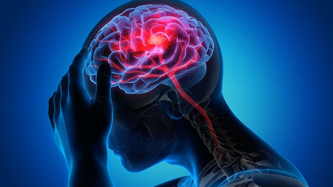Brain Hemorrhage: రోజురోజుకీ పెరుగుతున్న బ్రెయిన్ హెమరేజ్ కేసులు.. వ్యాధి ఏమిటి, లక్షణాలు, నివారణ తెలుసుకోండి