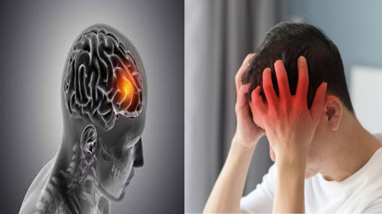 Brain Tumor diseases: ఈ సమయంలో తలనొప్పి వస్తుంటే నెగ్లెక్ట్ చేయకండి.. బ్రెయిన్ ట్యూమర్ కావొచ్చు.. లక్షణాలు ఏమిటంటే..