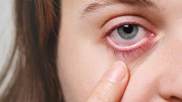 Diabetes: డయాబెటిస్తో బాధపడుతున్నారా.? కంటి సమస్యలు రాకూడదంటే..