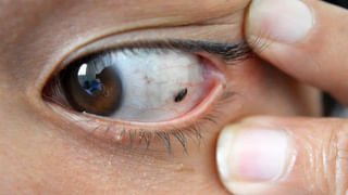 Blood Donation: క్యాన్సర్ రోగులు రక్తదానం చేయవచ్చా? నిపుణులు చెప్పిన సమాధానం ఏమిటంటే