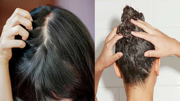 Hair Care Tips: ఒత్తైన జుట్టు కోరుకునే వారికి ఇదొక వరం..ఇలా వాడితే అదిరిపోయే రిజల్ట్!