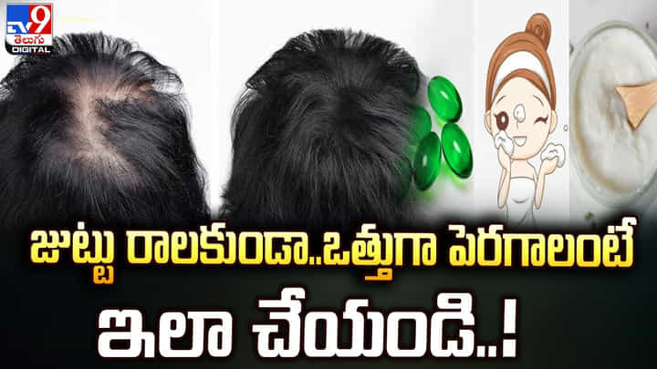 జుట్టు రాలకుండా.. ఒత్తుగా పెరగాలంటే ఇలా చేయండి జుట్టు రాలకుండా.. ఒత్తుగా పెరగాలంటే ఇలా చేయండి