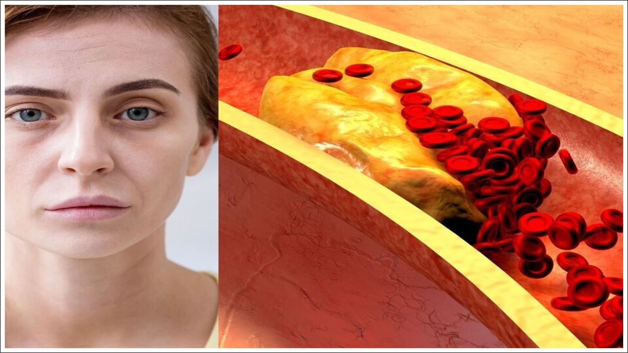 Cholesterol: మీ ముఖంపై ఈ లక్షణాలు కనిపిస్తున్నాయా? చెడు కొలెస్ట్రాల్‌కు సంకేతాలు