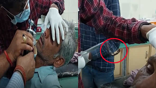 వృద్ధ రైతుకు తీవ్రమైన తలనొప్పి.. ఆస్పత్రి వెళ్లగా.. ముక్కులో ఏముందో చూసి డాక్టర్లు షాక్