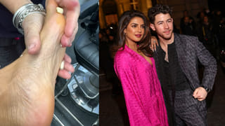 Skin Health: చర్మ ఆరోగ్యాన్ని దెబ్బతీసే ఫుడ్‌ ఇవే.. వీటికి దూరంగా ఉండడమే బెటర్‌