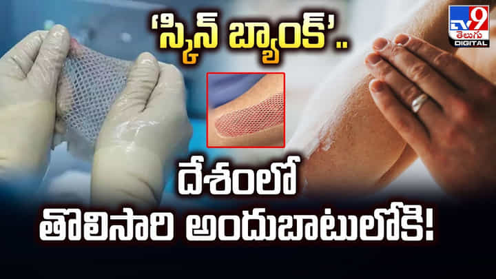 ‘స్కిన్ బ్యాంక్’.. దేశంలో తొలిసారి అందుబాటులోకి ‘స్కిన్ బ్యాంక్’.. దేశంలో తొలిసారి అందుబాటులోకి