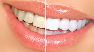 Lifestyle: మీరు కూడా టైట్‌ జీన్స్‌ ధరిస్తున్నారా.? ఈ సమస్యలు తప్పవంటోన్న నిపుణులు