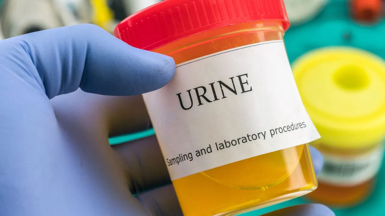 Urine Infection:  శరీరంలో నీటి కొరత యూరిన్ ఇన్‌ఫెక్షన్‌కు గురి చేస్తుంది.. ఈ లక్షణాలు కనిపిస్తే జాగ్రత్త..