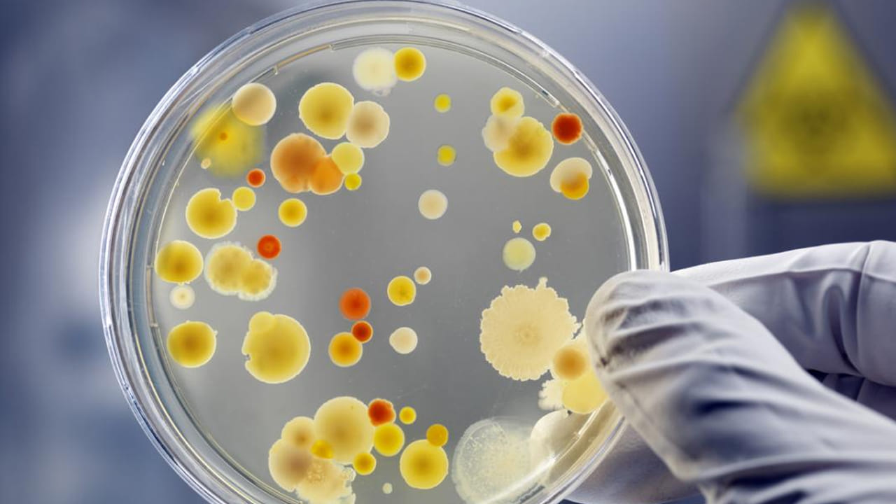 ఇదిలా తాజాగా వెలువడిన సర్వే వివరాల ప్రకారం ఒక్క యాపిల్ లో కోట్ల బ్యాక్టీరియా ఉంటుందని చెబుతున్నారు నిపుణులు. మరి ఈ బ్యాక్టీరియా మనకు మంచి చేస్తుందా, చెడును కలుగజేస్తుందా అన్నది అందరికీ ఆసక్తిని కలిగించే విషయం.