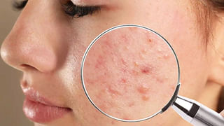 Get Rid of Rats: ఇంట్లో ఎలుకల బెడదా.. ఈ చిట్కాలతో బయటకు తరిమేయండి..