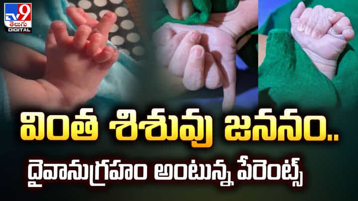 వింత శిశువు జననం.. దైవానుగ్రహం అంటున్న పేరెంట్స్ వింత శిశువు జననం.. దైవానుగ్రహం అంటున్న పేరెంట్స్
