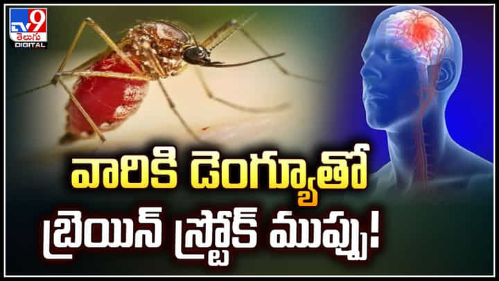 Brain Stroke: అలాంటి వారికి డెంగ్యూతో బ్రెయిన్ స్ట్రోక్ ముప్పు.! నిపుణుల షాకింగ్ న్యూస్.. Brain Stroke: అలాంటి వారికి డెంగ్యూతో బ్రెయిన్ స్ట్రోక్ ముప్పు.! నిపుణుల షాకింగ్ న్యూస్..