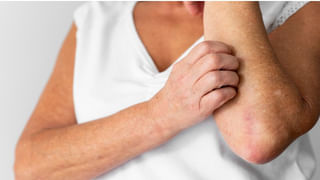 Fatty Liver: మీ శరీరంలో ఆ మార్పులు కనిపిస్తున్నాయా? తస్మాత్‌ జాగ్రత్త.. ప్రమాదానికి చాలా దగ్గర్లో ఉన్నట్లే..!