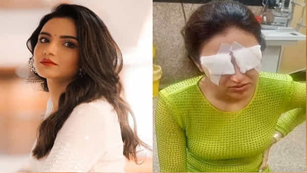 Eye Contact Lens: కాంటాక్ట్ లెన్స్ వల్ల నటి జాస్మిన్ భాసిన్కు తీవ్ర అనారోగ్యం.. ఈ తప్పులు మీరు చేయకండి