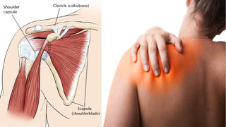 High Cholesterol: మహిళలను భయపెడుతున్న కొలెస్ట్రాల్.. కొత్త లక్షణాలు ఇవే!