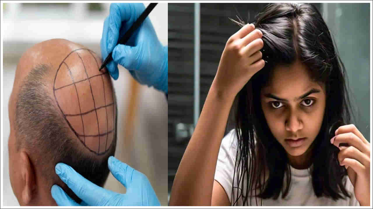 Hair Transplant: జుట్టు రాలిపోయే సమస్య ఎప్పుడు కనిపిస్తుంది? హెయిర్ ట్రాన్స్‌ప్లాంట్కు అనువైన వయసు ఏది?