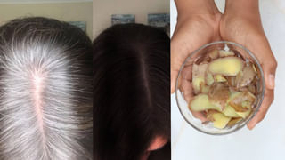 Hair Transplant: జుట్టు రాలిపోయే సమస్య ఎప్పుడు కనిపిస్తుంది? ‘హెయిర్ ట్రాన్స్‌ప్లాంట్’కు అనువైన వయసు ఏది?