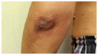 Almonds: బాదం తింటే కొలెస్ట్రాల్‌ పెరుగుతుందా.? ఇందులో నిజం ఎంత.?