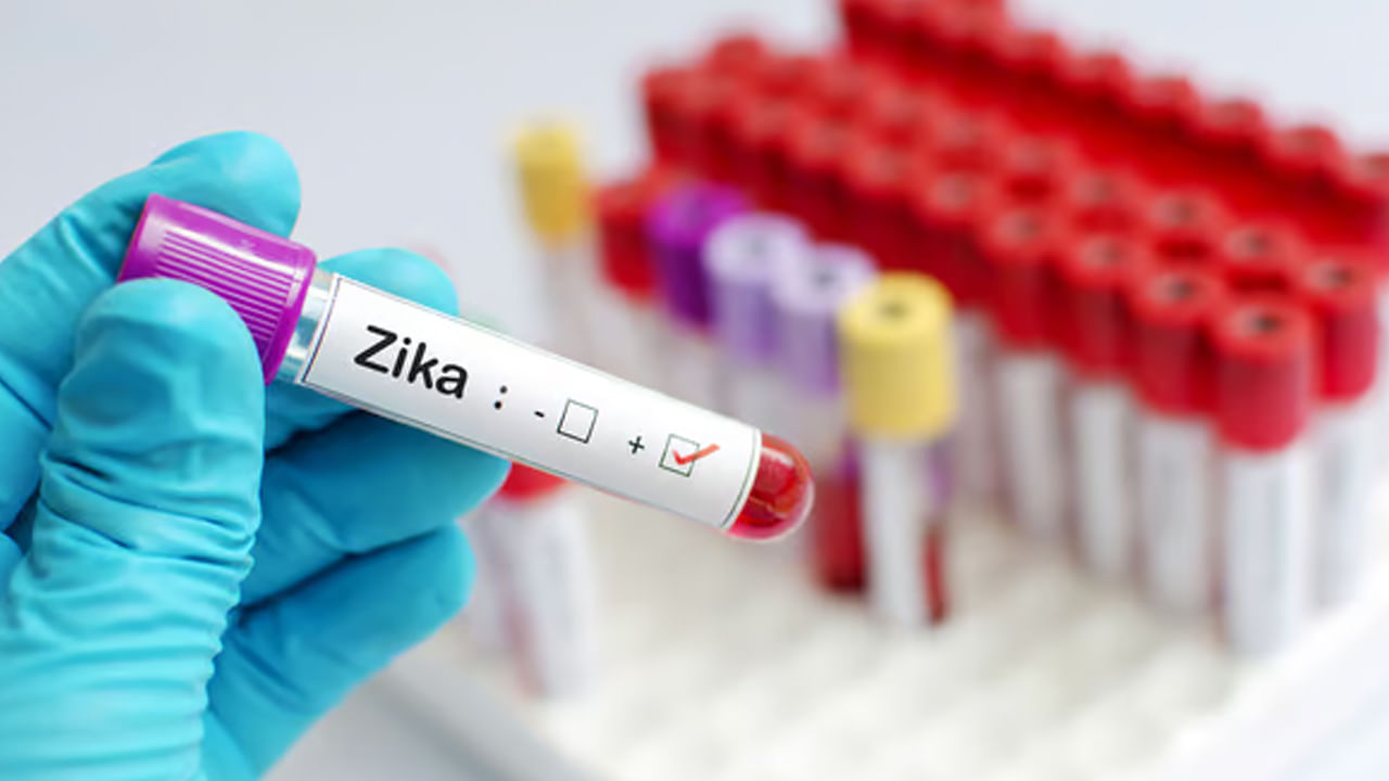Zika Virus: పూణేలో వ్యాపిస్తున్న జికా వైరస్.. 6 కేసులు నమోదు.. డాక్టర్, ఆమె కుమార్తెకు పాజిటివ్