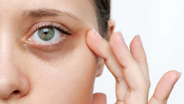Dark Circles: డార్క్ సర్కిల్స్ని పర్మినెంట్గా ఎలా దూరం చేయాలనుకుంటున్నారా..? ఇలా ట్రై చేయండి..